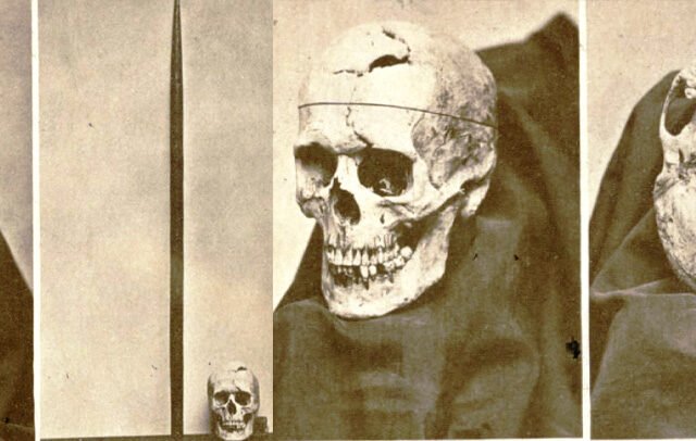 Phineas Gage